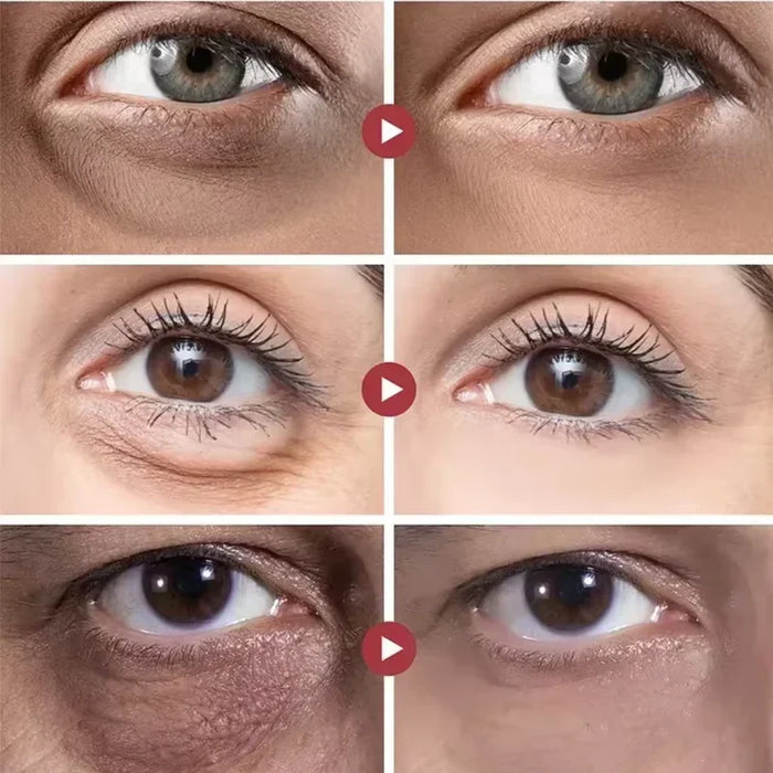 Rolon 5 em 1 Ultra Rejuvenescedor Luteína Inova® PAGUE 1 LEVE 3